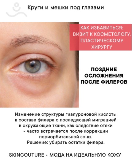 Изображение выглядит как текст, Человеческое лицо, ресница, снимок экранаКонтент, сгенерированный ИИ, может содержать ошибки.